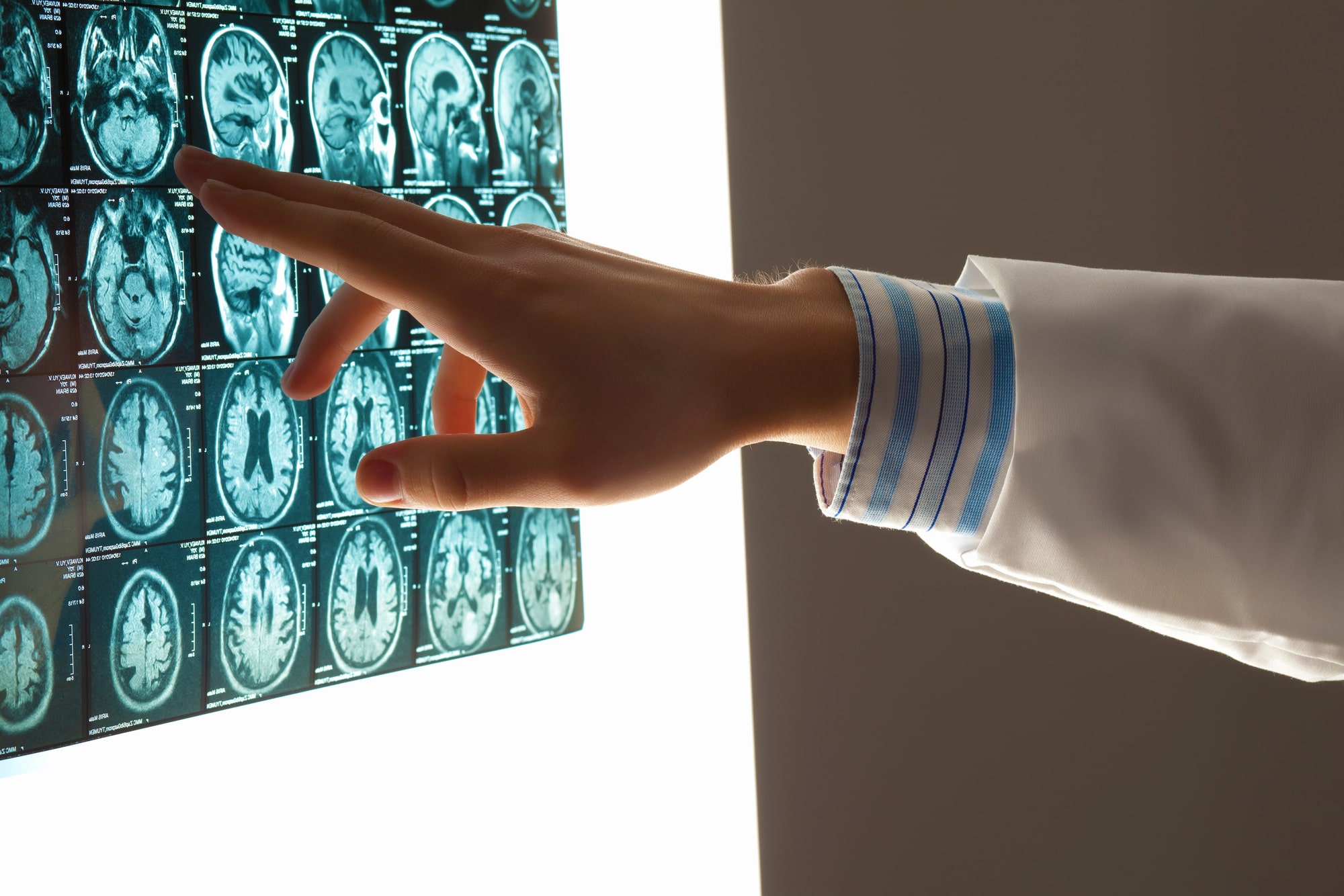 New Haven brain injury lawyer team