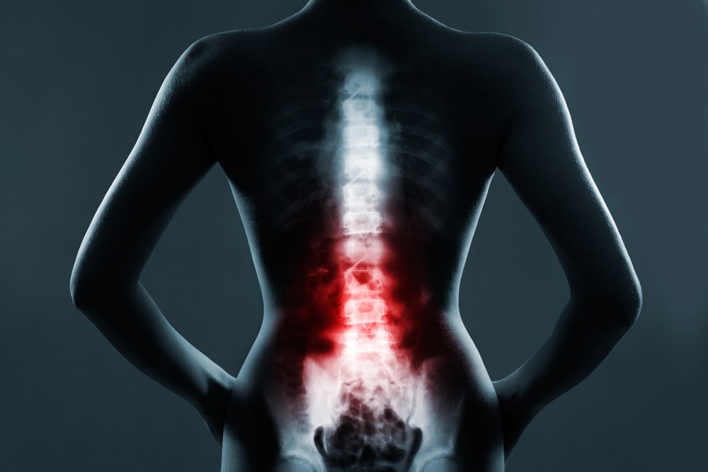 spinal cord injury lawyer New Haven, CT